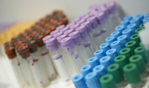 Sanidad confirma un caso de viruela del mono en Gran Canaria y notifica cinco nuevos en estudio