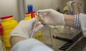 Sanidad registra dos positivos y notifica tres nuevos casos para estudio de viruela del mono